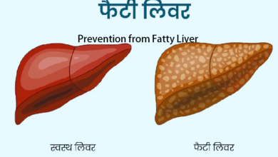 Fatty Liver